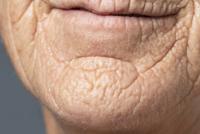 jeonmyeon bogi suseog yeoseong ilban pibu jilgam