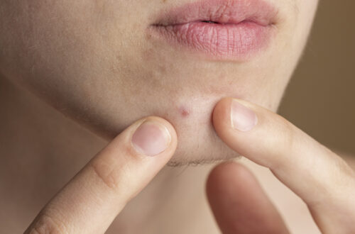 eolgul gwanli lutin dong an pibu mogong eul dadseubnida 2