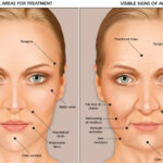 1 jowls orig