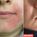 37772264 0 image a 64 1611702060859