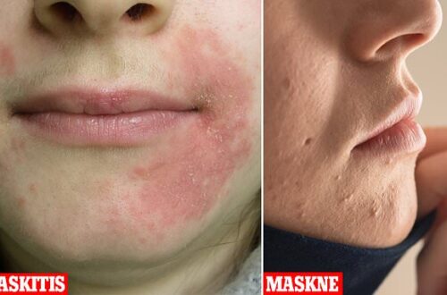 1일 1팩 부작용으로 과영양 접촉성 피부염 생기는 이유 6 37772264 0 image a 64 1611702060859