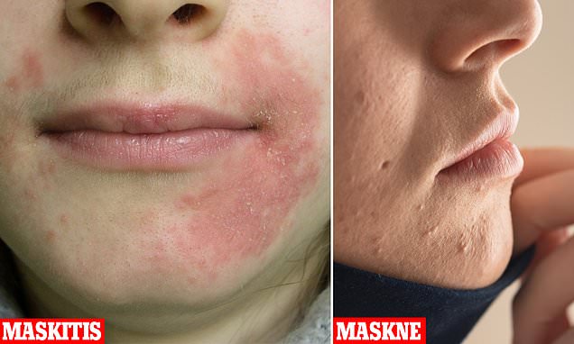 37772264 0 image a 64 1611702060859