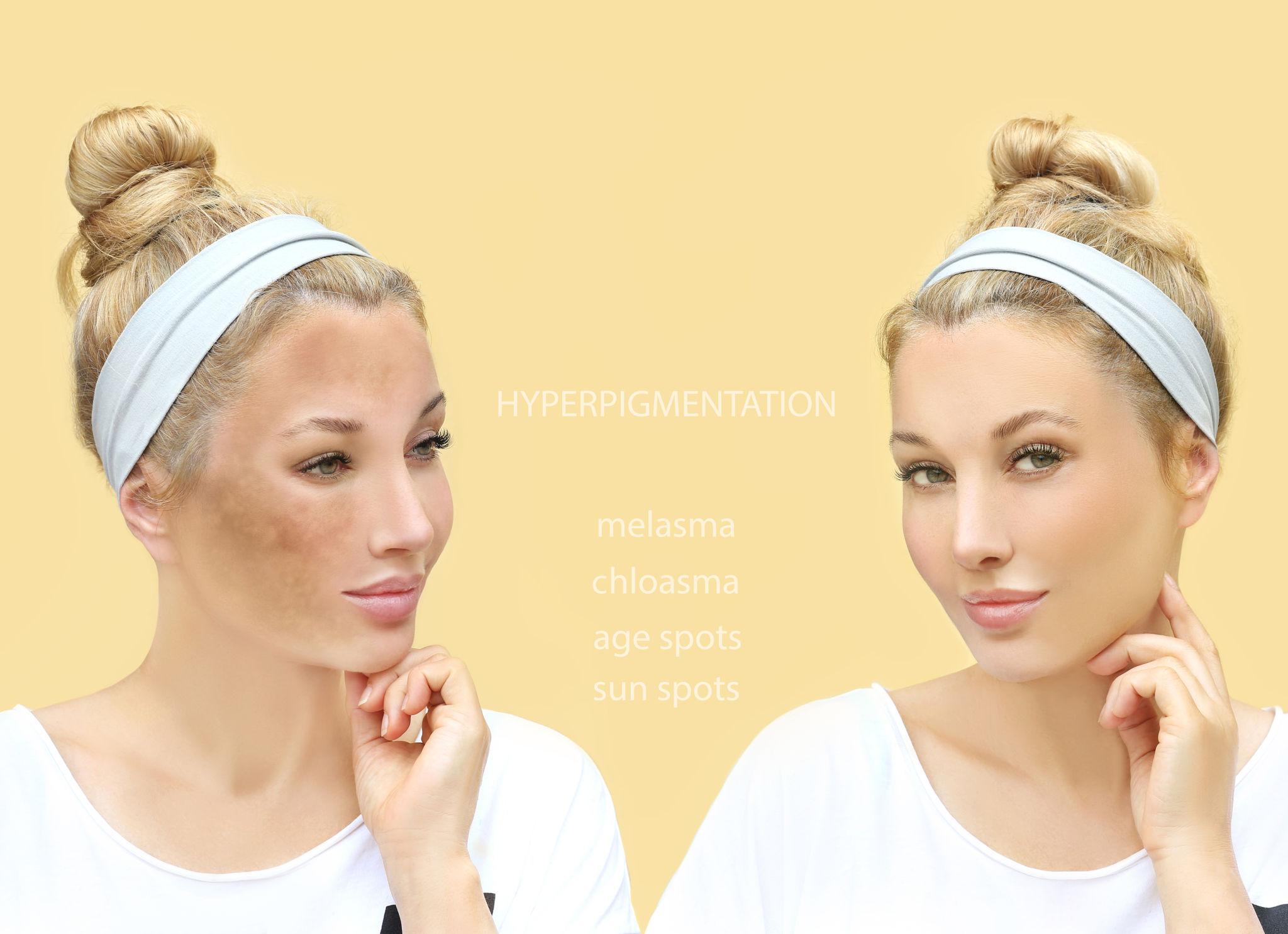 UALIxILQt28oG fdx4aG uZXV SbrTpDg9OFg1Psb yvuFdh1cDaf 0STMCtThDk3riMIGJbUwQ7EpV3rk3 FrGcjUqoVkmisLy8U1p6Pw4